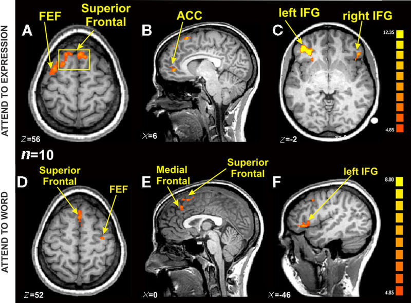 mind-brain fmri